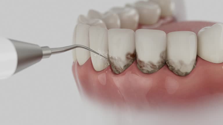 Reliable Dental contractor in Covington, OH by Smile Center Dentistry